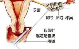 宁波做试管婴儿多少钱？浙江宁波906医院试管婴儿怎么样？