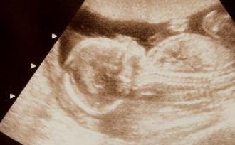 解放军306医院试管怎么样？