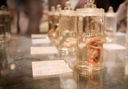 2026泌乳素高影响试管移植着床吗多少钱？